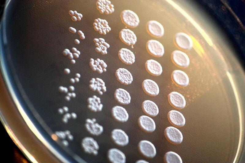 File:Saccharomyces cerevisiae culture.jpg